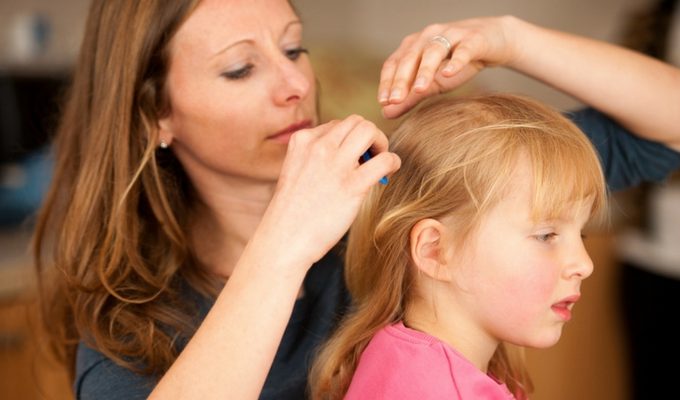Lice Removal Places Near Grand Rapids, Plus How to Remove Lice 