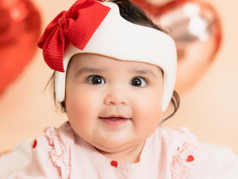cranial technologies baby in helmet with red bow